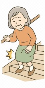 変形性膝関節症　進行について