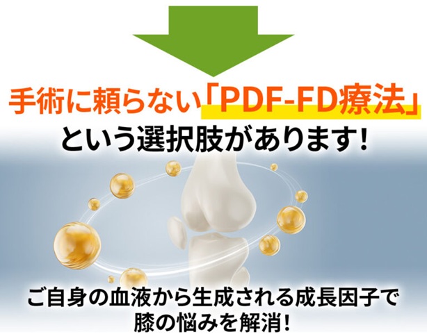 変形性膝関節症の治療　PDF-FD