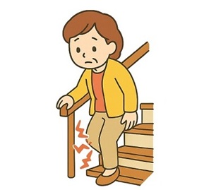 変形性膝関節症の進行　中期