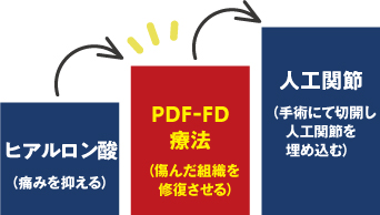 次世代オーダーメイド治療　PDF-FD治療