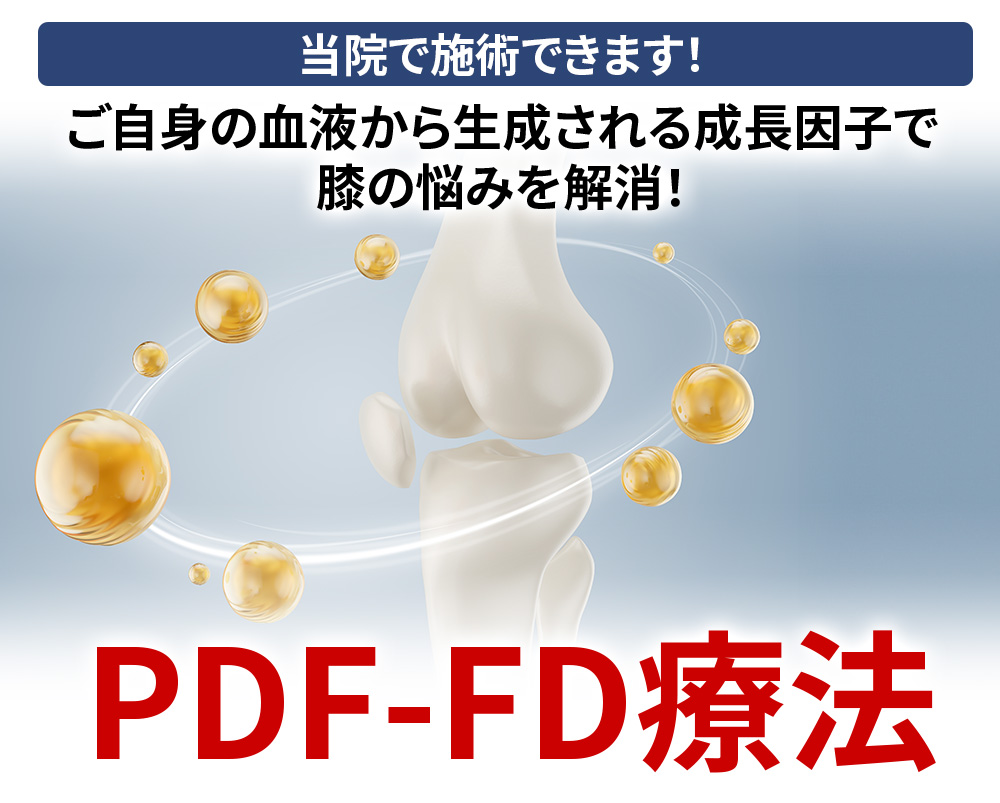 膝の痛みの次世代オーダーメイド治療　PDF-FD治療